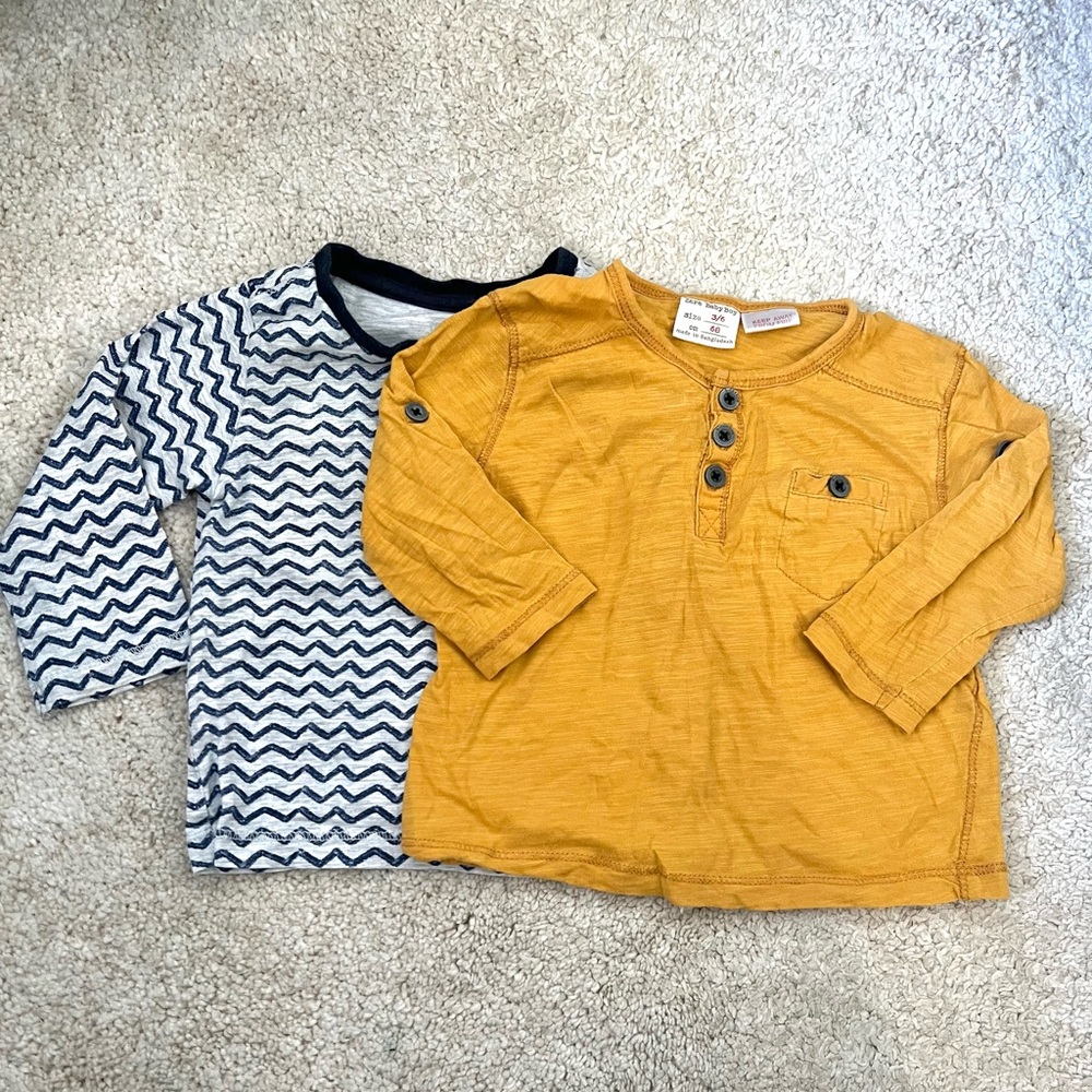 Button Tops bundle!